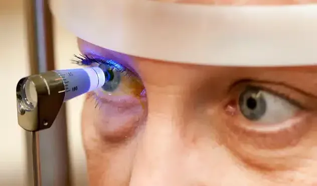 Control de Glaucoma